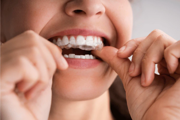 Enhancing Oral Comfort: Improved Function